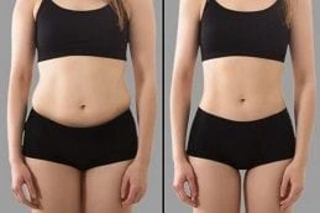 Fat Reduction Before & After