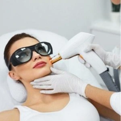 Fractional Laser with PRP Therapy in Dubai