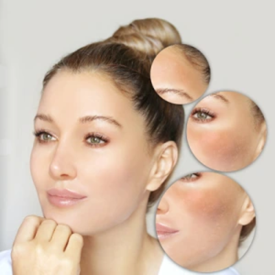 Skin Whitening Treatment in Dubai